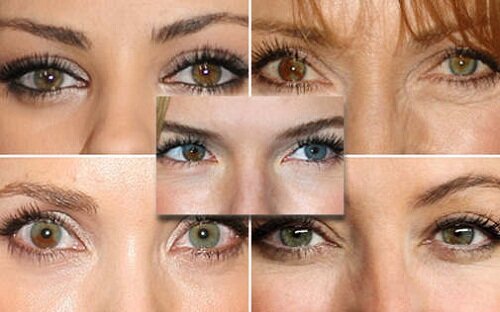 разные глаза